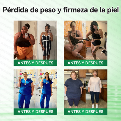 𝑻𝒊𝒆𝒏𝒅𝒂 𝑶𝒇𝒊𝒄𝒊𝒂𝒍 | 🏆🏆𝑮𝑳𝑶𝑹𝑬𝐍𝐃𝗔® 𝗠𝗼𝗿𝙞𝙣𝙜𝙖 · 𝘽𝙚𝙧𝙗𝙚𝙧𝙞𝙣𝒂 × 𝑵𝑨𝐃+ 𝐏𝐚𝐫𝐜𝙝𝙚 𝘼𝙫𝙖𝙣𝙯𝙖𝙙𝗼 𝗱𝗲 𝗠𝗶𝗰𝗿𝗼𝒏𝒂𝒍𝒈𝒂 𝑵𝒂𝐧𝐨 𝟏0-𝙚𝙣-1(𝐒𝐨𝐥𝐨 𝐮𝐧𝐚 𝐯𝐞𝐳 𝐚𝐥 𝐝í𝐚） ✅ 𝐏𝐚𝐫𝐚 𝐥𝐚 𝐨𝐛𝐞𝐬𝐢𝐝𝐚𝐝, 🅟🅘🅔🅛 🅕🅛🅐🅒🅘🅓🅐, 𝐝𝐢𝐚𝐛𝐞𝐭𝐞𝐬, 𝐚𝐩𝐧𝐞𝐚 𝐝𝐞𝐥 𝐬𝐮𝐞ñ𝐨, 𝐩𝐫𝐨𝐛𝐥𝐞𝐦𝐚𝐬 𝐚𝐫𝐭𝐢𝐜𝐮𝐥𝐚𝐫𝐞𝐬, 𝐲 𝐦𝐮𝐜𝐡𝐨 𝐦á𝐬